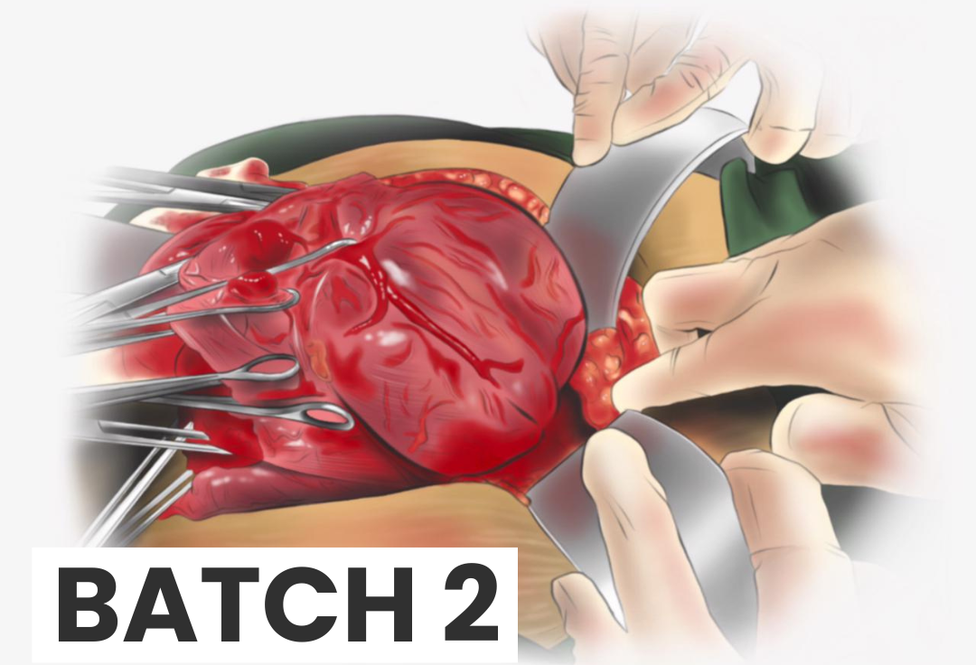 Batch 2 (2026) - Advanced Course of Placenta Accreta